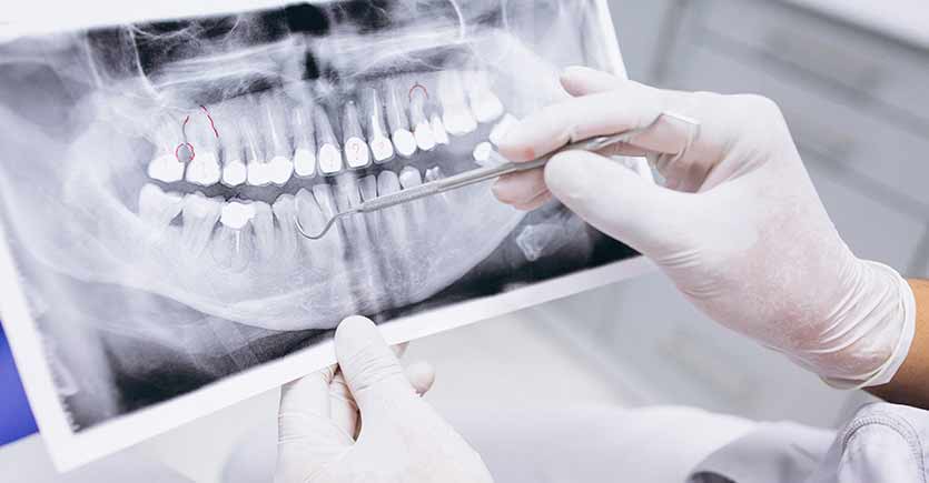 Endodoncia-Centro-Odontologico-teruel